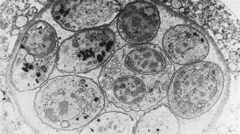 Taxoplasma gondii: ¡Un parásito escurridizo que puede controlar las mentes de sus huéspedes!